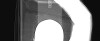 SPORK, NICO - 22.03.1976 - 02.08.2022 - CT obere Extremität - 17:55:42